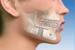 Best dentist in Gorakhpur, Dentist in Gorakhpur, Dental Hospital in Gorakhpur, Dental clinic in Gorakhpur, Esthetic dentist in Gorakhpur, Best dental surgeon in Gorakhpur, Dental Implants Doctors in Gorakhpur, Best dental clinic in Gorakhpur